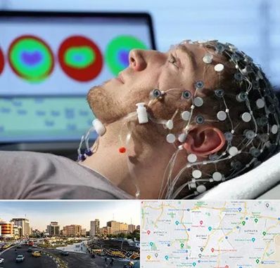 مرکز نوار مغز در منطقه 7 تهران 