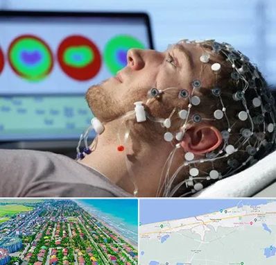 مرکز نوار مغز در فریدونکنار