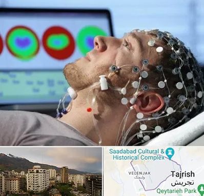 مرکز نوار مغز در زعفرانیه 