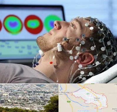 مرکز نوار مغز در یاسوج