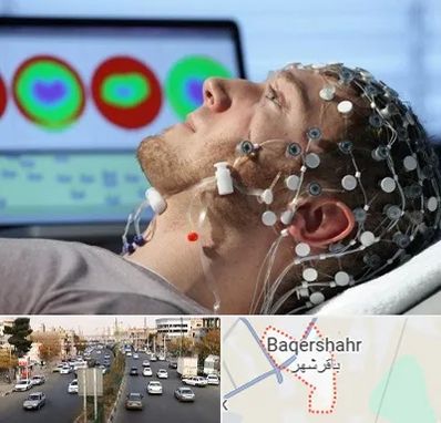 مرکز نوار مغز در باقرشهر