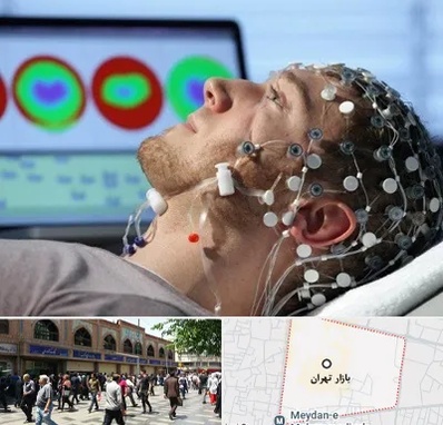 مرکز نوار مغز در بازار تهران