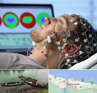 مرکز نوار مغز در بندر انزلی