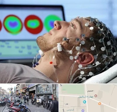 مرکز نوار مغز در چهارراه استانبول
