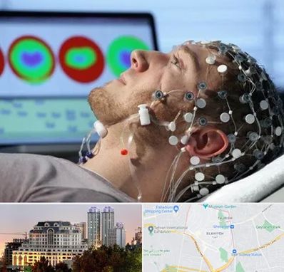 مرکز نوار مغز در فرشته 