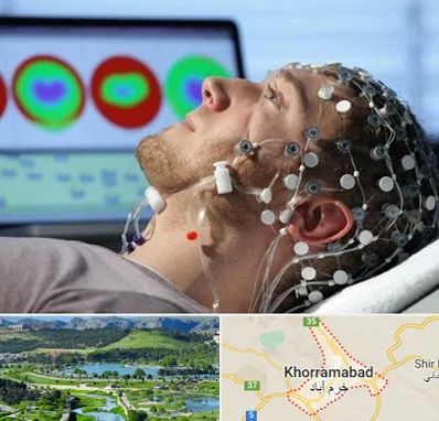 مرکز نوار مغز در خرم آباد