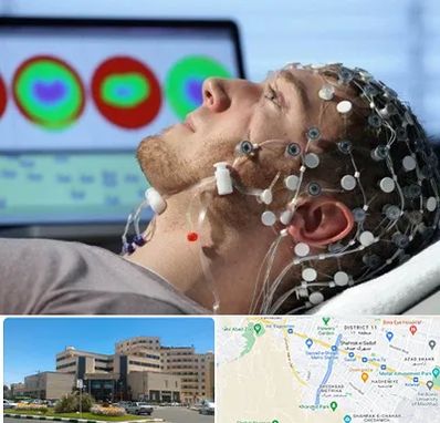 مرکز نوار مغز در صیاد شیرازی مشهد 