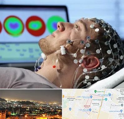 مرکز نوار مغز در مارلیک کرج 