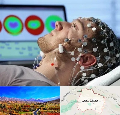 مرکز نوار مغز در خراسان شمالی