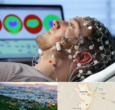 مرکز نوار مغز در سنندج