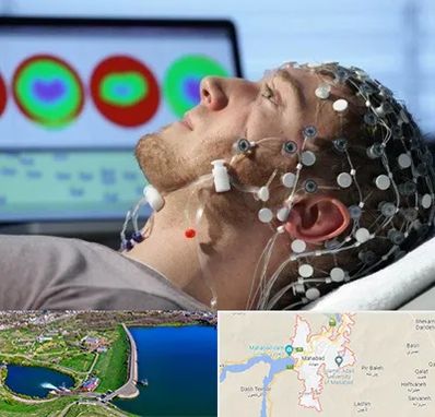 مرکز نوار مغز در مهاباد