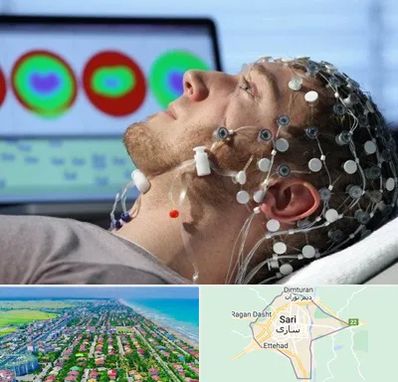 مرکز نوار مغز در ساری