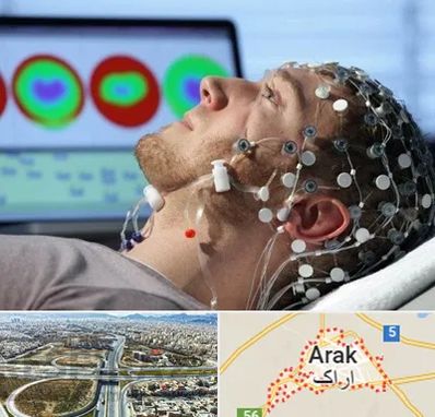 مرکز نوار مغز در اراک