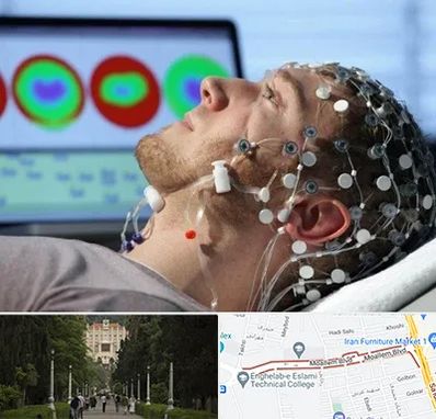 مرکز نوار مغز در بلوار معلم رشت 