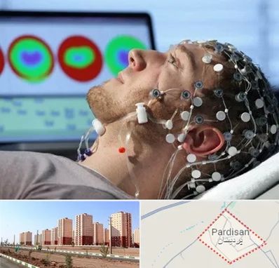 مرکز نوار مغز در پردیسان قم