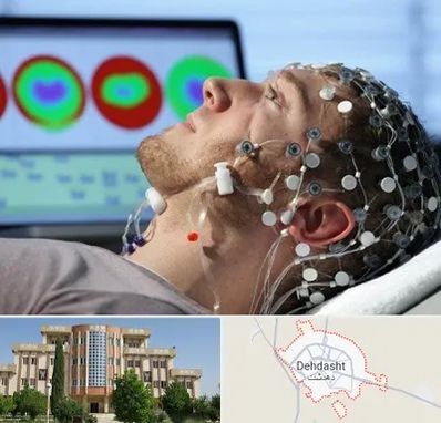 مرکز نوار مغز در دهدشت