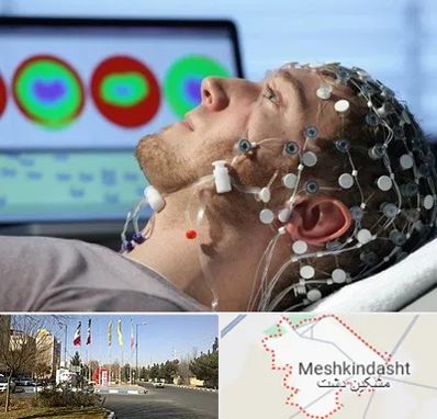 مرکز نوار مغز در مشکین دشت