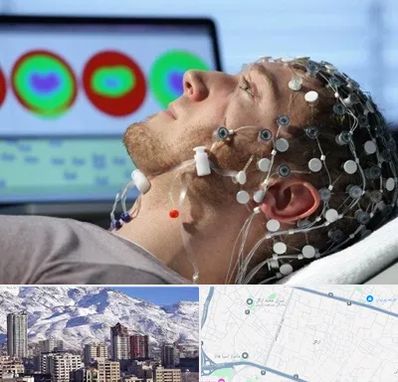 مرکز نوار مغز در ازگل