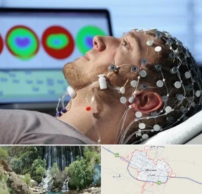 مرکز نوار مغز در شیروان