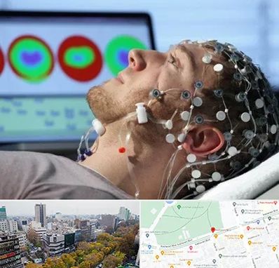 مرکز نوار مغز در بلوار کشاورز 