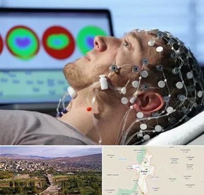 مرکز نوار مغز در بوکان
