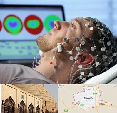 مرکز نوار مغز در ساوه