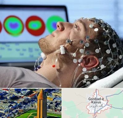 مرکز نوار مغز در گنبد کاووس