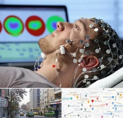 مرکز نوار مغز در فاطمی 