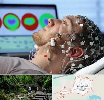 مرکز نوار مغز در علی‌ آباد کتول