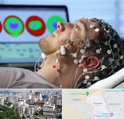 مرکز نوار مغز در ولنجک 