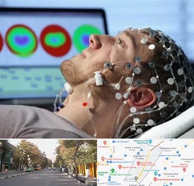 مرکز نوار مغز در شریعتی 