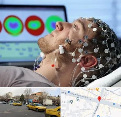 مرکز نوار مغز در شهناز تبریز