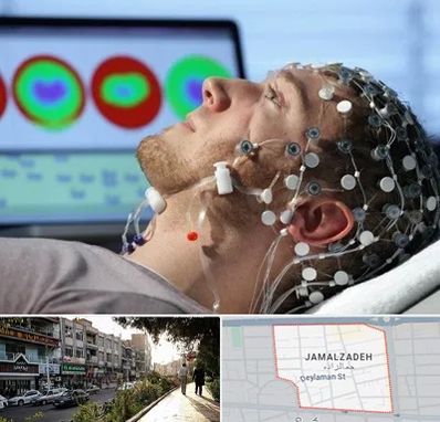 مرکز نوار مغز در خیابان جمالزاده