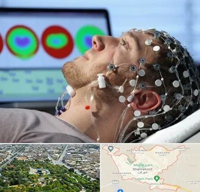 مرکز نوار مغز در شهرکرد