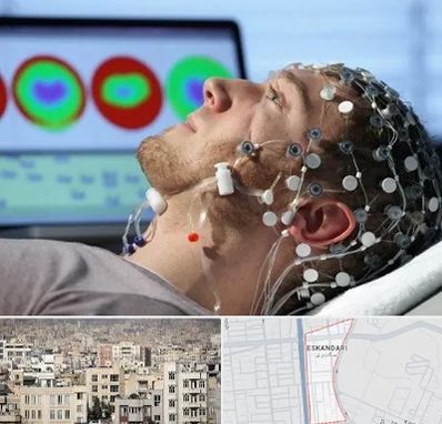 مرکز نوار مغز در اسکندری