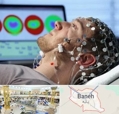 مرکز نوار مغز در بانه