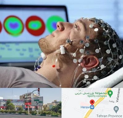 مرکز نوار مغز در هروی 