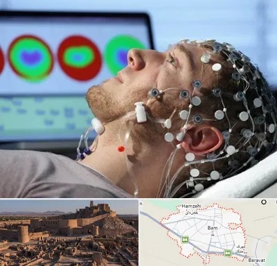مرکز نوار مغز در بم