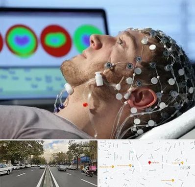 مرکز نوار مغز در دولت 