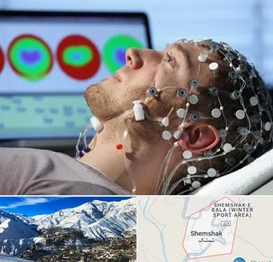 مرکز نوار مغز در شمشک