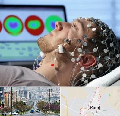 مرکز نوار مغز در گوهردشت کرج 