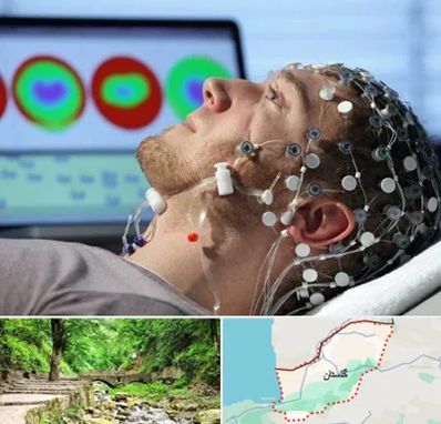 مرکز نوار مغز در گلستان