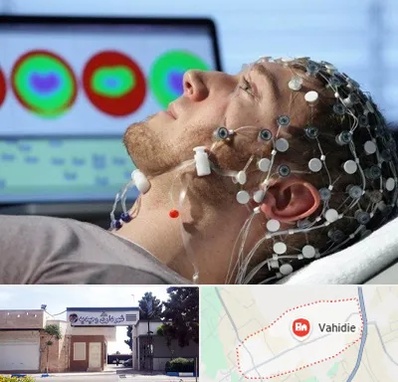 مرکز نوار مغز در وحیدیه شهریار