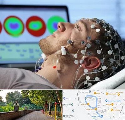 مرکز نوار مغز در فلکه گاز رشت 