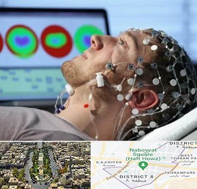 مرکز نوار مغز در نارمک 