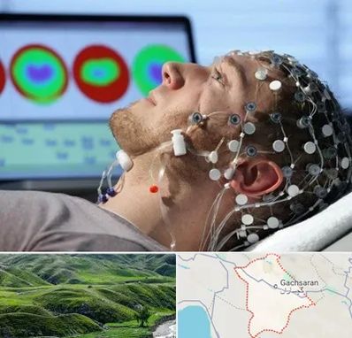 مرکز نوار مغز در گچساران