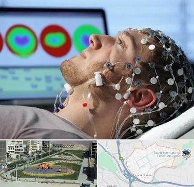 مرکز نوار مغز در مرزداران تبریز