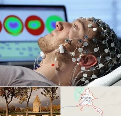 مرکز نوار مغز در تویسرکان