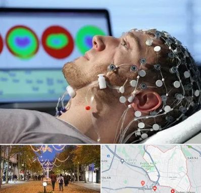 مرکز نوار مغز در ولیعصر ارومیه