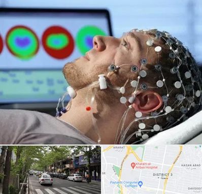 مرکز نوار مغز در ظفر 